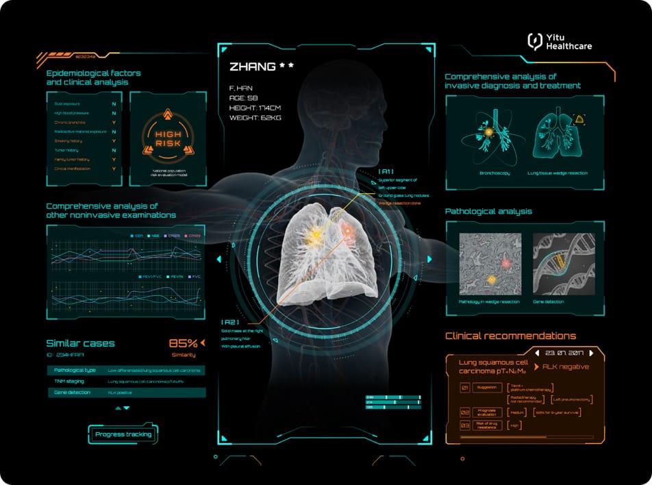 care.aiTM肺癌多學(xué)科智能診斷系統(tǒng)