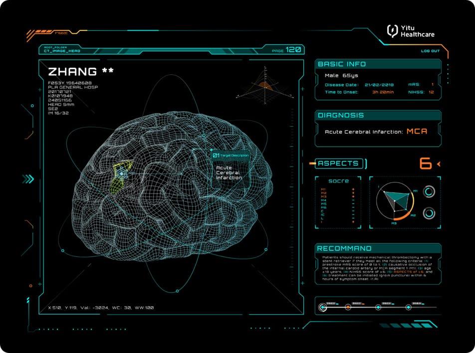 care.aiTM 卒中多學(xué)科智能決策支持系統(tǒng)